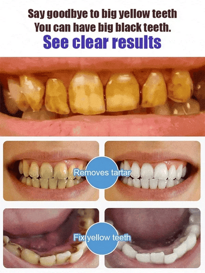 Yayashi SP4 Probiotic Whitening Toothpaste 120g