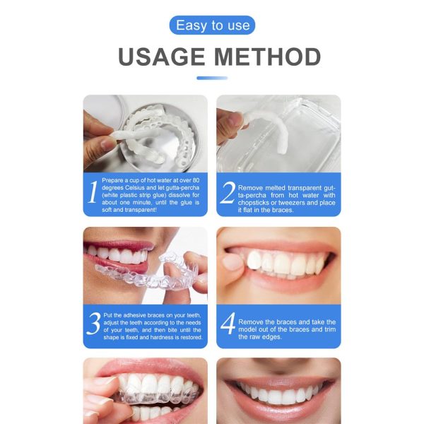 Snap on Smile Instant Confidence with a Brighter