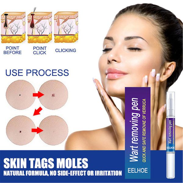 Warts Remover Original Cream Wart Removal Ointment