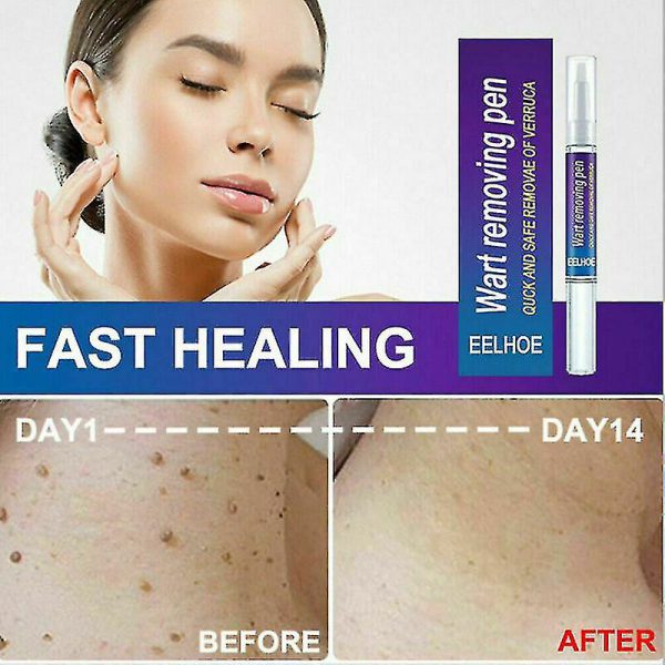 Warts Remover Original Cream Wart Removal Ointment